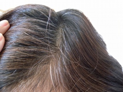 白髪を防ぐおすすめ食材＆頭皮ケア