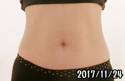 シックスパッド腹筋の筋トレ効果（1ヶ月後）女性
