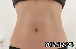シックスパッド腹筋の筋トレ効果（2ヶ月後）女性